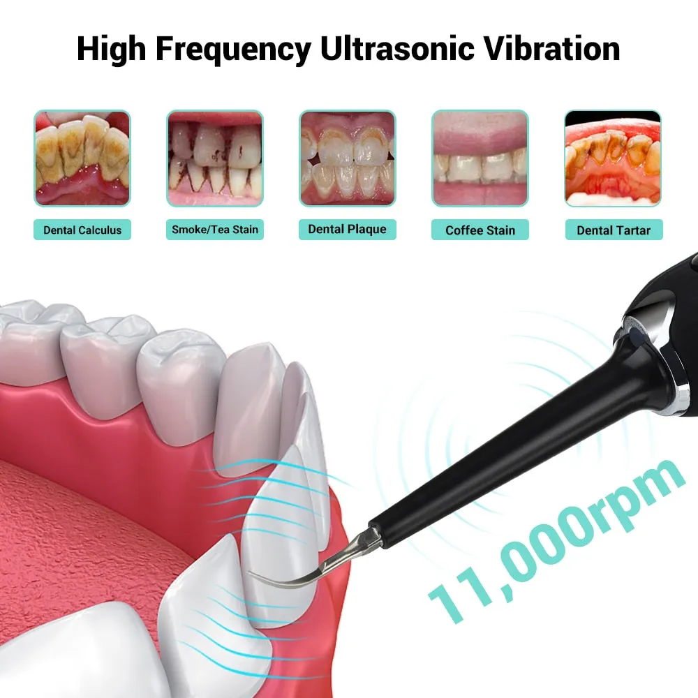 High Frequency Dental Teeth Whitening Electric Tooth Brush For